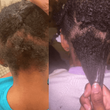 She Got Inches Hair Growth Duo Bundle